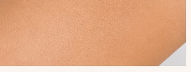 Underarms after 8 sessions